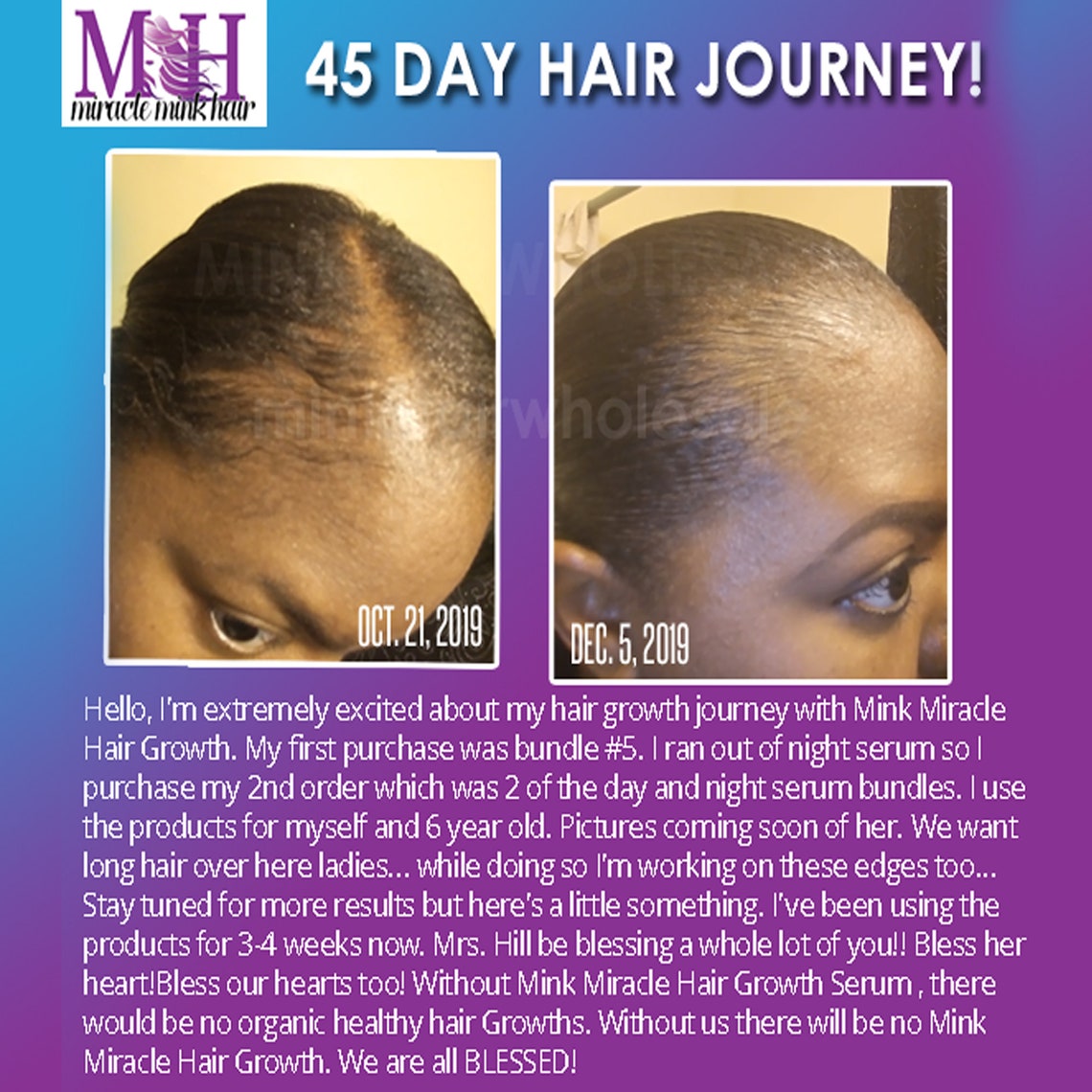 Miracle Mink Hair Grow Edge Control Repair Etsy