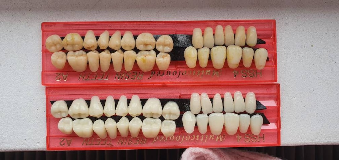 Resin Tooth Example 28 Resin Teeth. Realistic Morbid Human Tooth Set. Perfect for Halloween ...