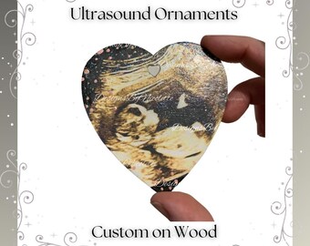 Custom Ultrasound Photo Wood Ornament: Personalized Baby Keepsake