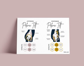 Pelvic Tilt // Chiropractic // Anterior Pelvic Tilt  // Spine // Anatomy Print // Vitalistic Chiro // Chiropractic Prints