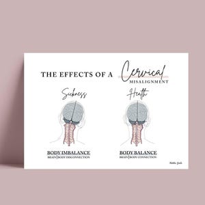 Cervical Misalignment Print // Body Imbalance Print // Spinal Nerve Chart // Chiropractic // Subluxation // Nervous System // Cervical Spine
