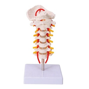 May include: A white anatomical model of the human cervical spine with red and yellow plastic nerve roots. The model is mounted on a white base.