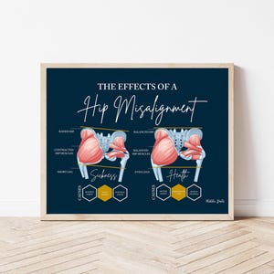 Hip Misalignment Print // Spinal Nerve Chart // Chiropractic // Subluxation // Nervous System // Healing // Hip Misalignment // Anatomy