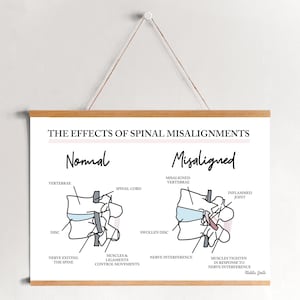 Your Nervous System // Chiropractic // Subluxation Complex  // Spinal Misalignments // Nervous System // Healing // Pain // Anatomy