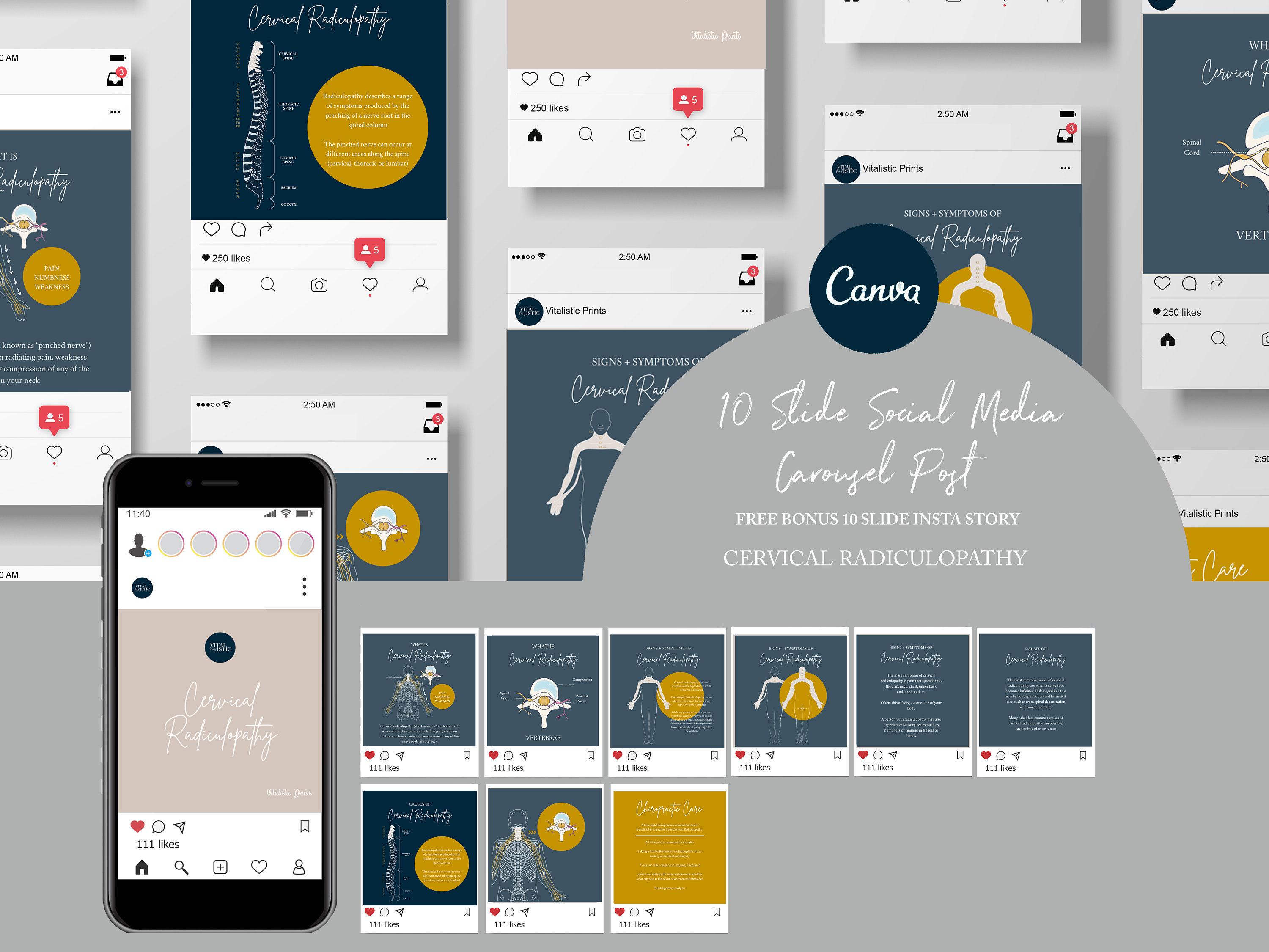 Chiropractic Canva Template For Instagram Post // Cervical Radiculopathy // Chiropractic Instagram Graphic