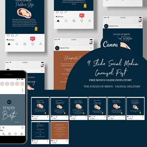Chiropractic Canva Template For Instagram Post // The Stages Of Birth // Chiropractic Instagram Graphic // Chiropractic Care // Subluxation