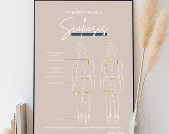 May include: A beige poster with a white outline of a person with scoliosis. The poster explains the effects of scoliosis, including head not centered over body, shoulder height difference, and hip prominence. The text "The Effects of a Scoliosis" is at the top of the poster.