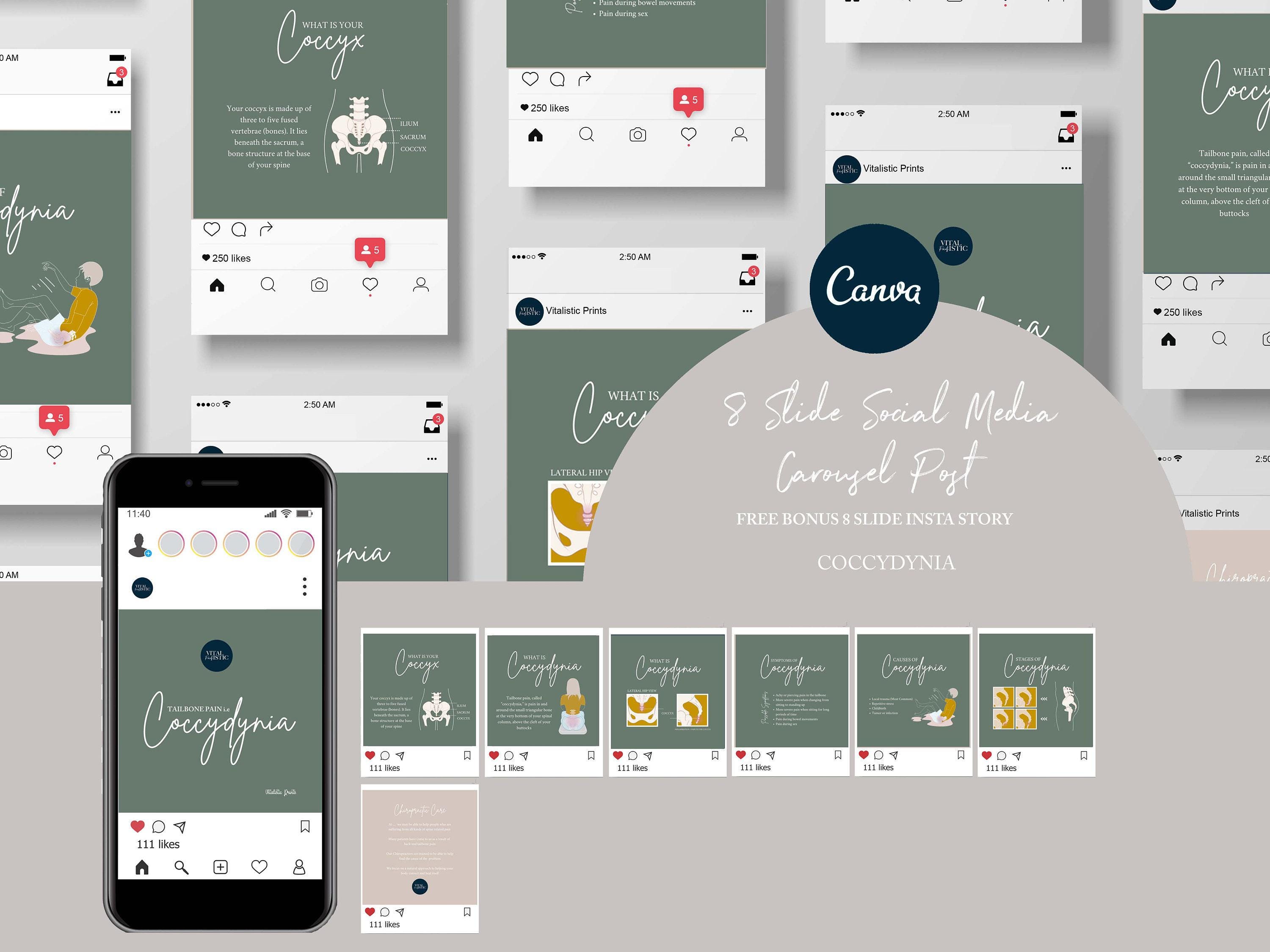 Chiropractic Canva Template For Instagram Post // Coccydynia // Tailbone Pain // Spine // Social Media Plans