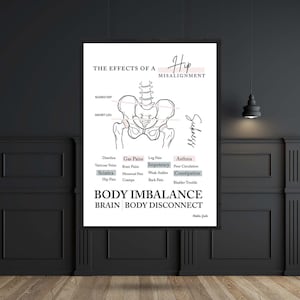 Hip Misalignment Print // Body Imbalance Print // Spinal Nerve Chart // Chiropractic // Subluxation // Nervous System // Hip Misalignment