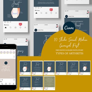 Chiropractic Canva Template For Instagram Post // Types Of Arthritis // Chiropractic Instagram Graphic // Chiropractic Care // Subluxation