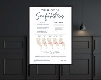The Stages Of Spondylolisthesis // Chiropractic // Subluxation // Anatomy Print // Vitalistic Chiro // Chiropractic Prints // Health Print