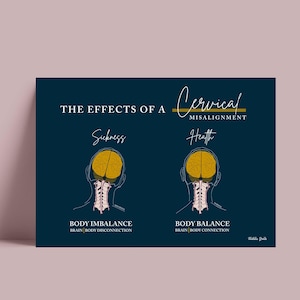 Cervical Misalignment Print // Body Imbalance Print // Spinal Nerve Chart // Chiropractic // Subluxation // Nervous System // Cervical Spine