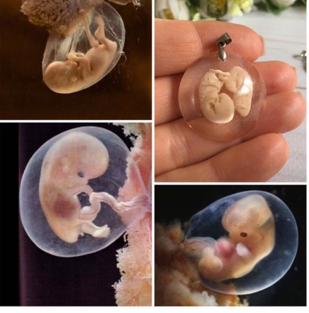 Embryo 10 Weeksloss Babymade To Order10weeks Gestation Etsy embryo-10-weeksloss-babymade-to-order10weeks-gestation-etsy