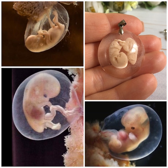 Embryon 7-8-9 semaines ornement de fausse couche sculpture - Etsy Canada