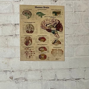 Retiring - Brain Medical Chart/Poster for Asylum, Hospital or Doctor’s Office  - this is not life size.