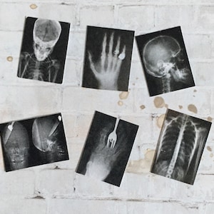 May include: A collection of black and white x-ray images, including a hand with a ring, a skull, a chest, and a leg with a fork.