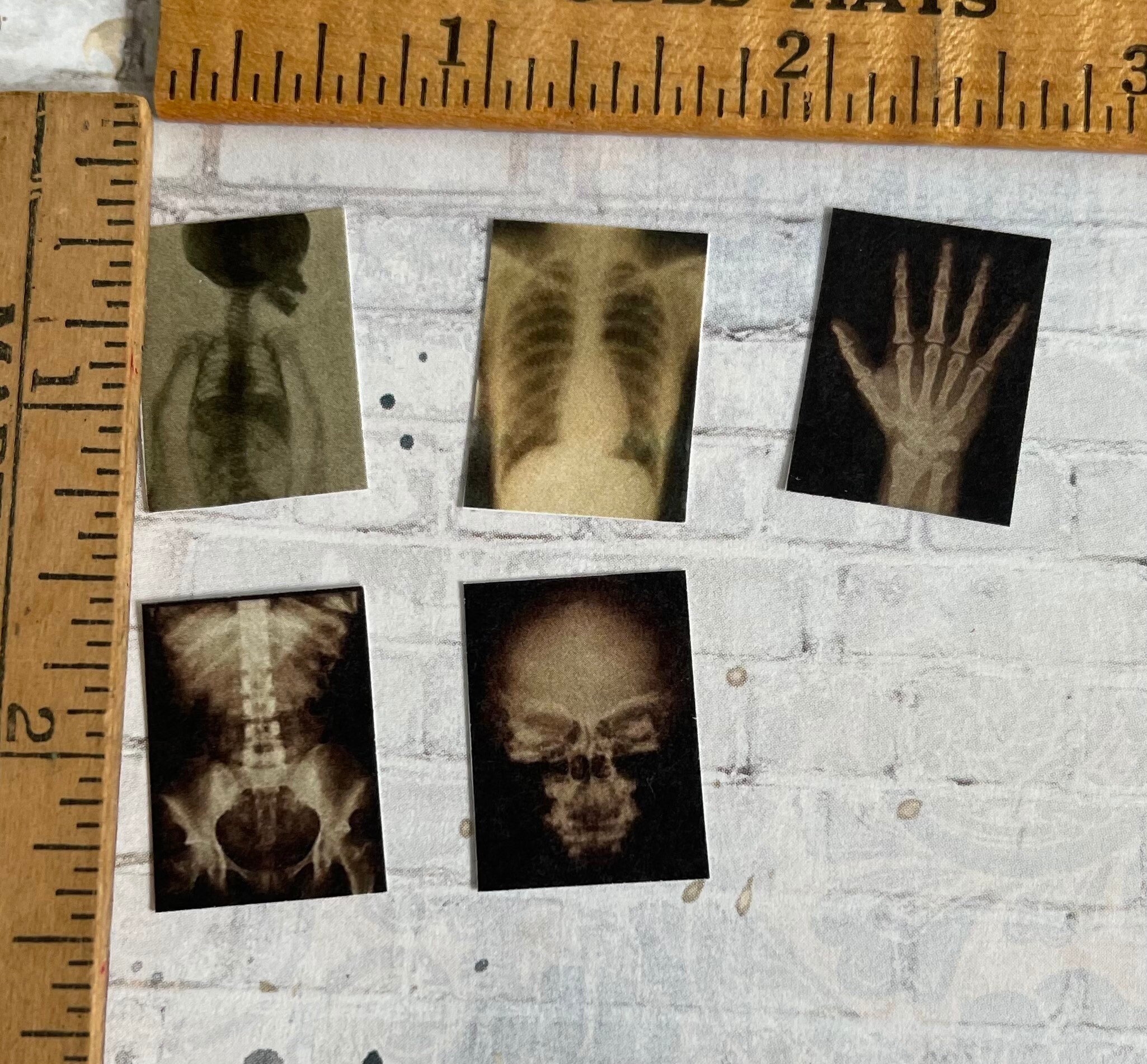 5 pc Vintage Medical XRays Etsy