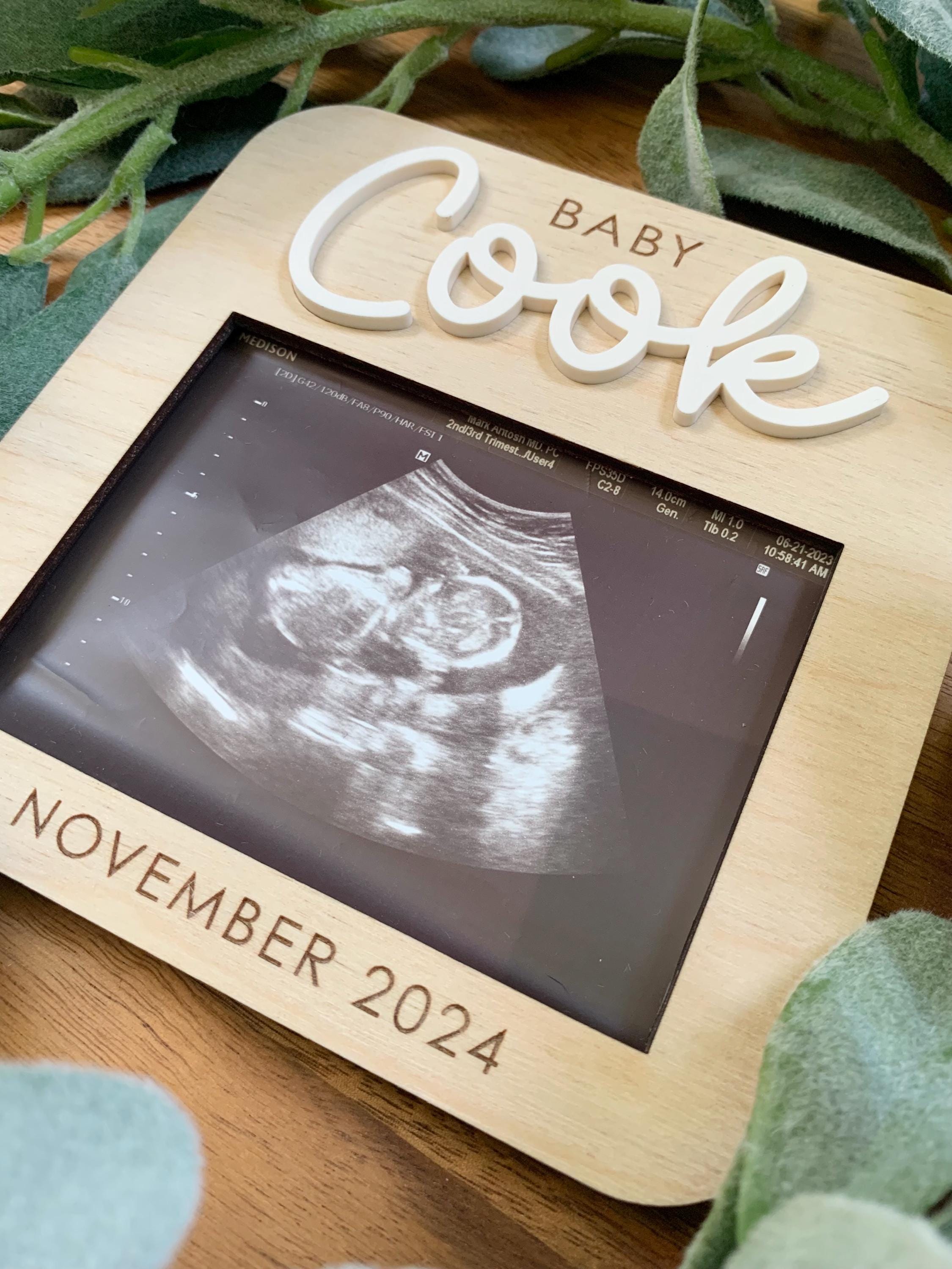 Sonogram Magnets Custom Sonogram Photo Frame Magnet: Pregnancy Announcement Keepsake - Etsy
