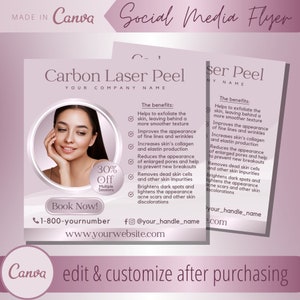 Modelo de folheto de tratamento a laser de carbono - Modelos de folhetos faciais de lasers de carbono - Postagem de peelings de carvão ativado - Folheto de tratamentos faciais de peeling de Hollywood