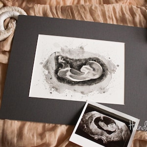 Acuarela ultrasónica personalizada según tu foto. Regalo pintado a mano para un nacimiento. Regalo de Navidad para mujeres embarazadas y futuros padres.