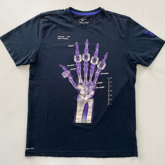 kobe broken hand shirt