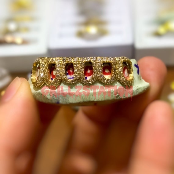 Diamond Grillz The Best Custom Grillz From H Town