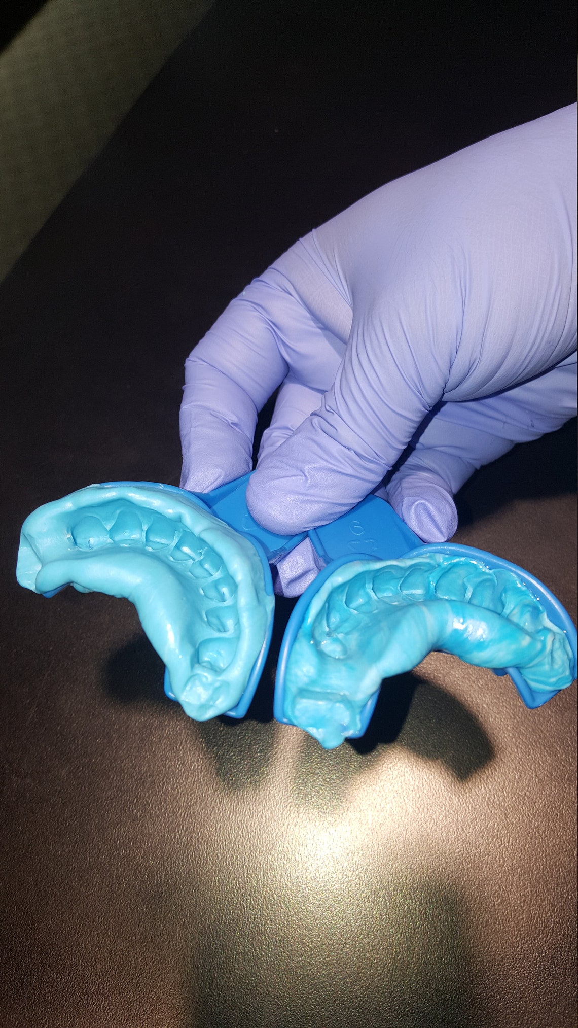 Grillz / Dental mold kit impression 2 mold kit for 12.99 Etsy
