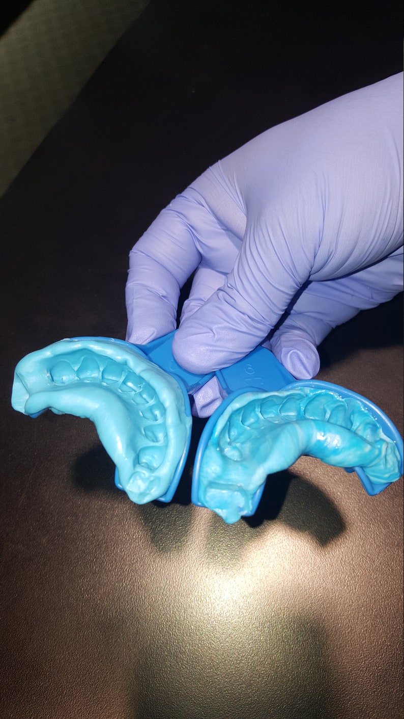 Grillz / Dental mold kit impression 2 mold kit for 12.99 Etsy
