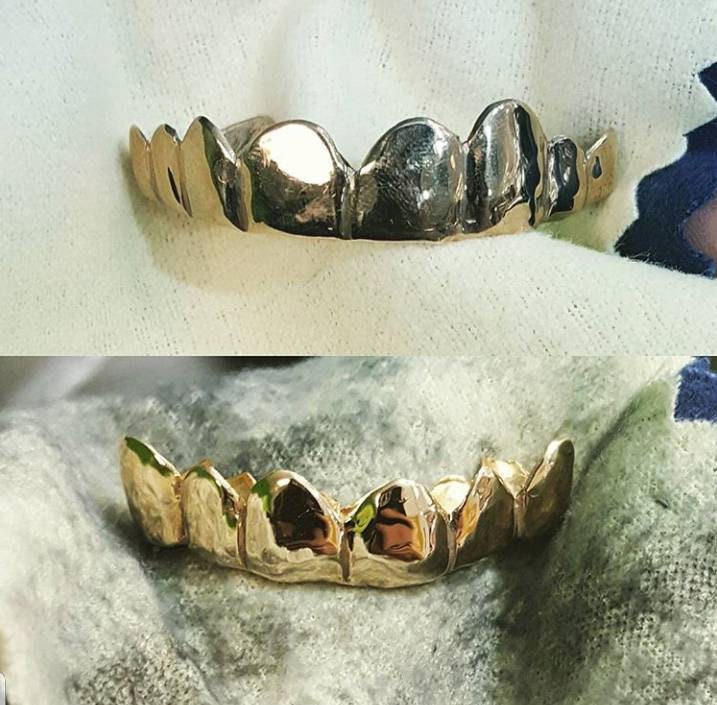 10 Amazing How To Clean Grillz Latest