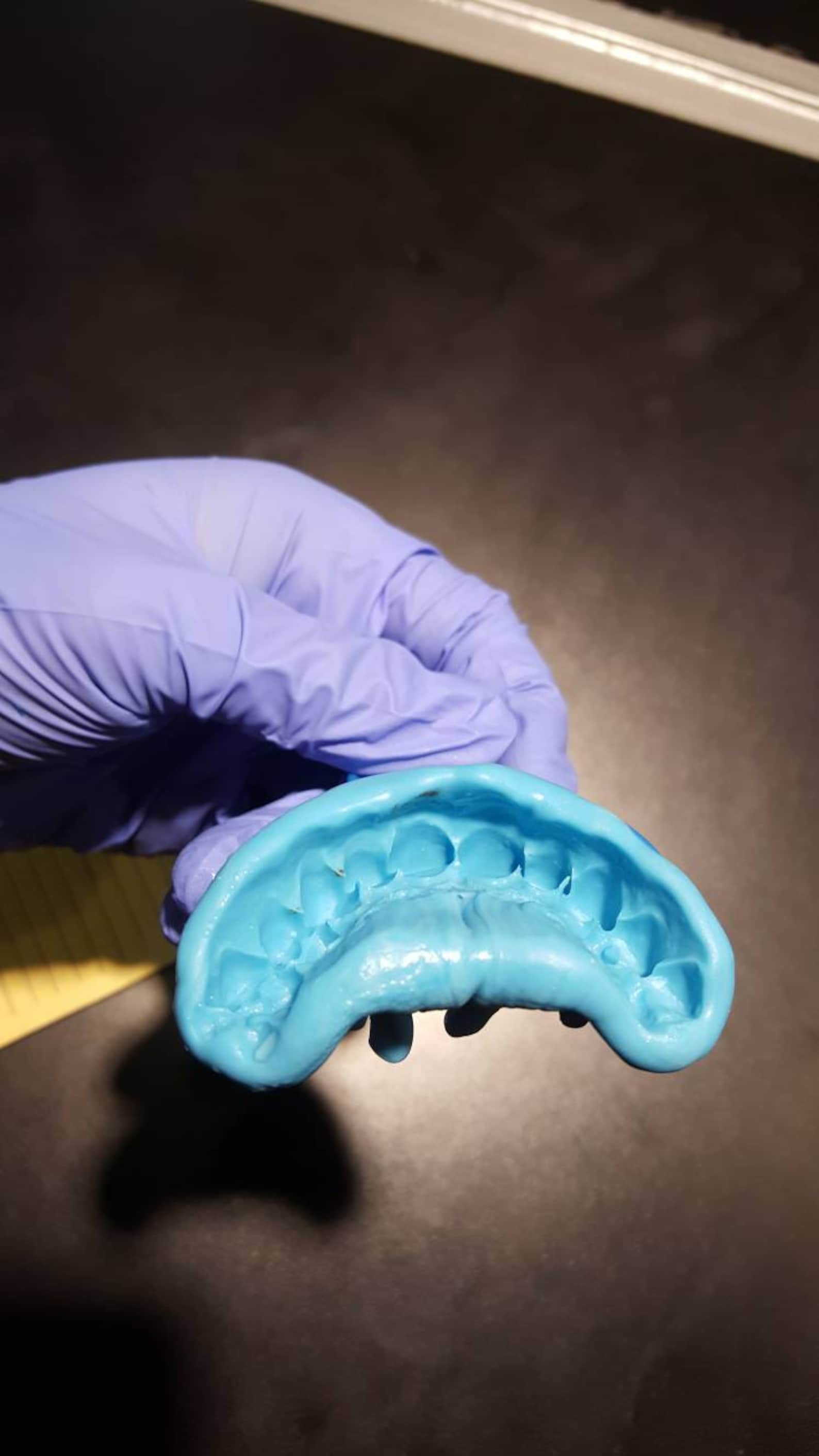 Grillz / Dental mold kit impression 2 mold kit for 12.99 Etsy