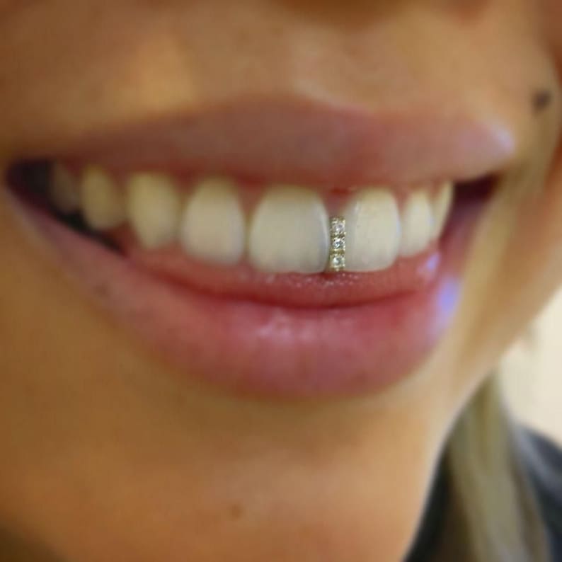 Custom Gap Filler Grillz / Teeth Silver Gold Diamonds Etsy UK