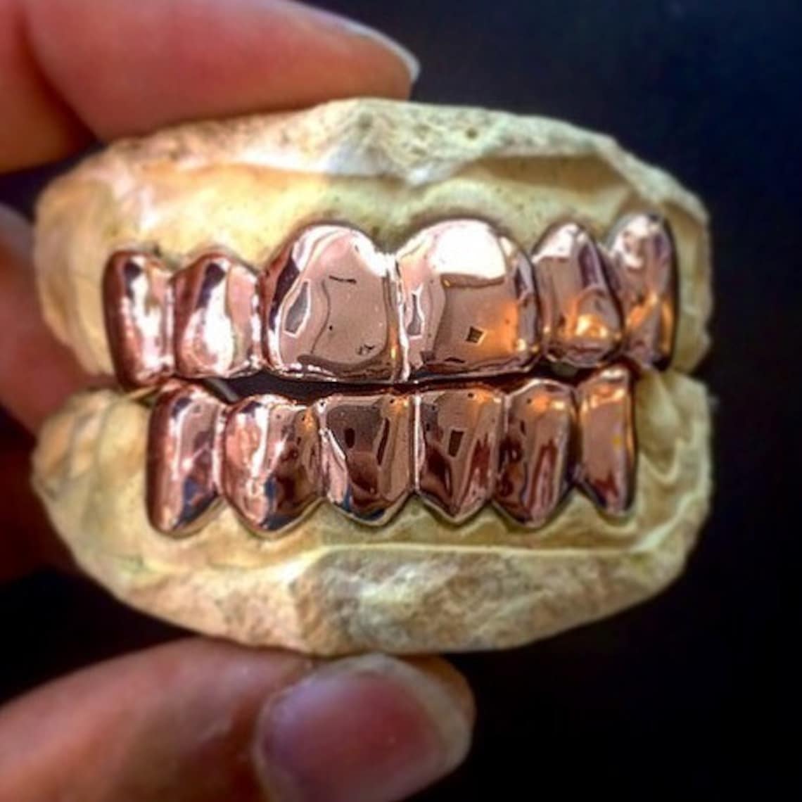 Custom 6 Set Rose Gold Grillz UK United Kingdom 10k 14k Etsy