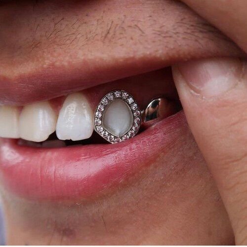 Natural Diamond Window Grillz/cap any Tooth Etsy