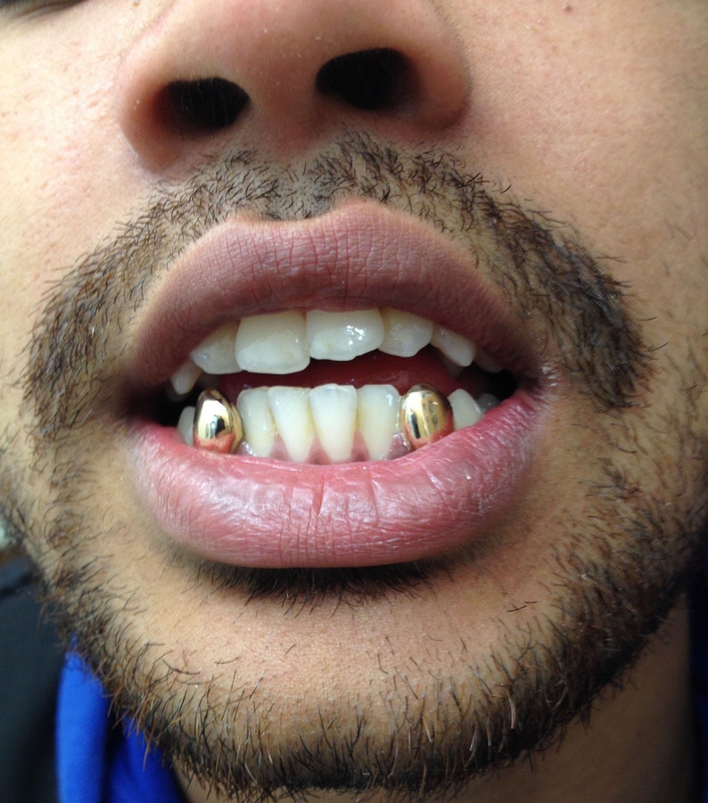 Custom Single Gold Grillz United Kingdom 10ct Gold Tooth Etsy
