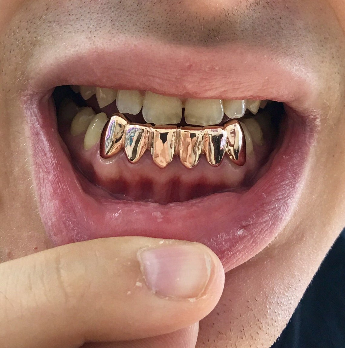 Custom 6 Set Rose Gold Grillz UK United Kingdom 10k 14k Etsy