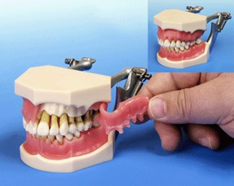 Higiene Periodontal Enfermedades Dentales Pérdida Ósea Depósitos de Cálculo Modelo Educativo