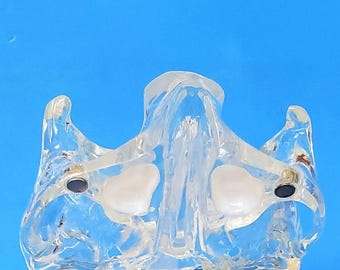 Modelo dental de elevación de senos nasales Presentación quirúrgica quirúrgica