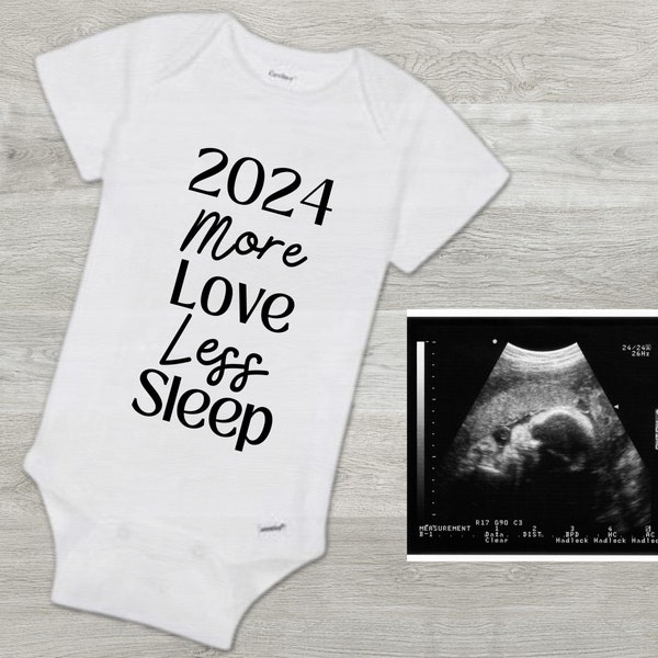2024 Baby Girl Pregnancy Announcement Etsy