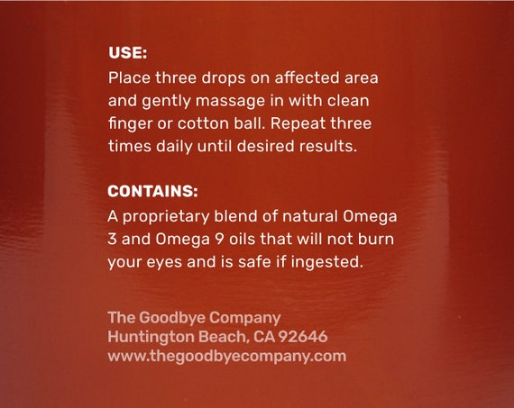 chalazion et bague en or chalazion et bague en or