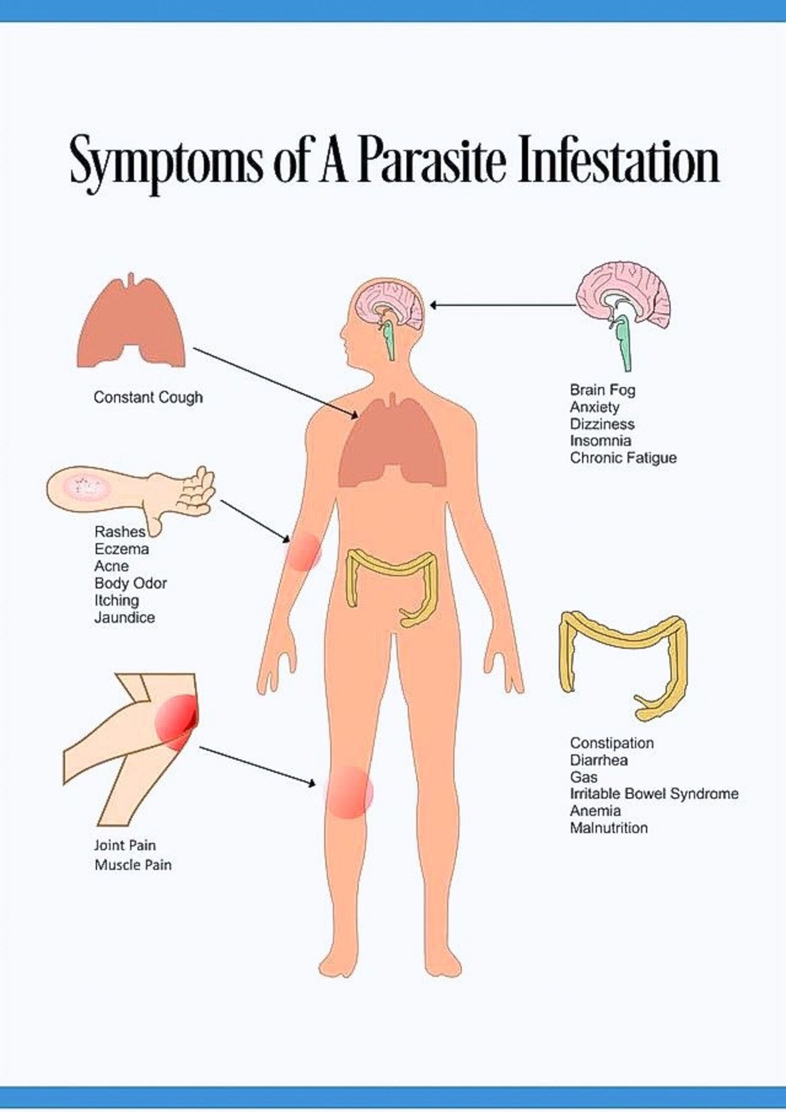 30 Day Full Body Parasite Detox With Essiac Detox Tea Etsy