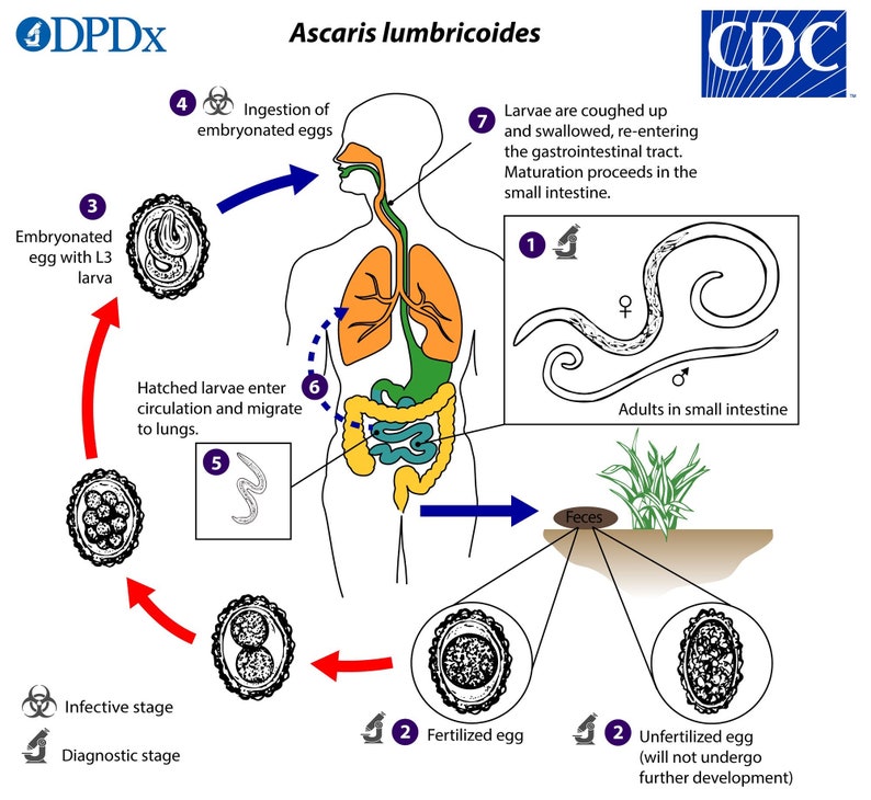 Body Parasite Detox at Anthony Lucio blog