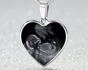 Ultrasound Pendant Baby's Sonogram 