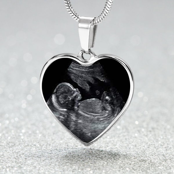 Ultrasound Pendant, Baby's Sonogram Necklace, New Pregnancy Gift, Congrats Pregnancy Gift for First Time Moms