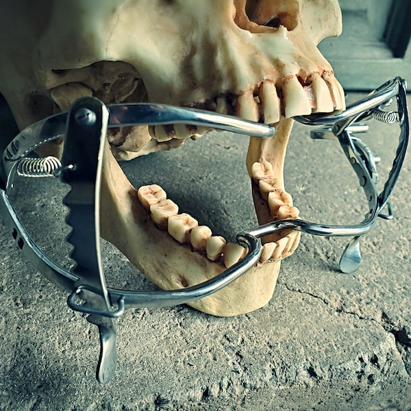 Medical mouth gag, oddities curiosities, vintage style mouth spreader