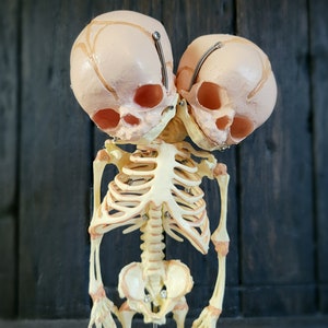 2 Headed fetal skeleton, oddities curiosities, life size human fetus replica, conjoined twins anatomical skeleton