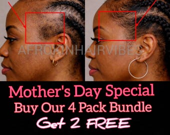 RESTORE DAMAGED HAIR-  Matcha Green Tea | Chebe Powder | Batana Oil Hair Growth Oil - Hair Stylist Formula