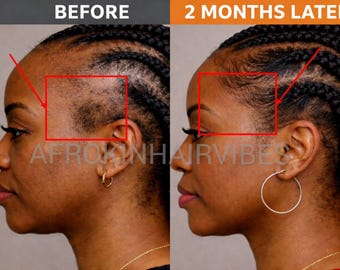 FOR MAXIMUM GROWTH -  Chebe Powder Batana Oil Hair Growth Oil for Sensitive Scalp - Hair Stylist Formula - Free Shipping