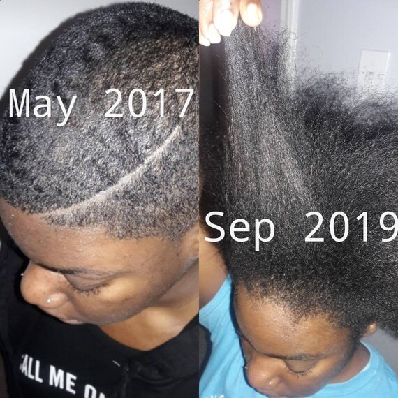 No More Shedding Rice Protein Hair Growth Shampoo Etsy