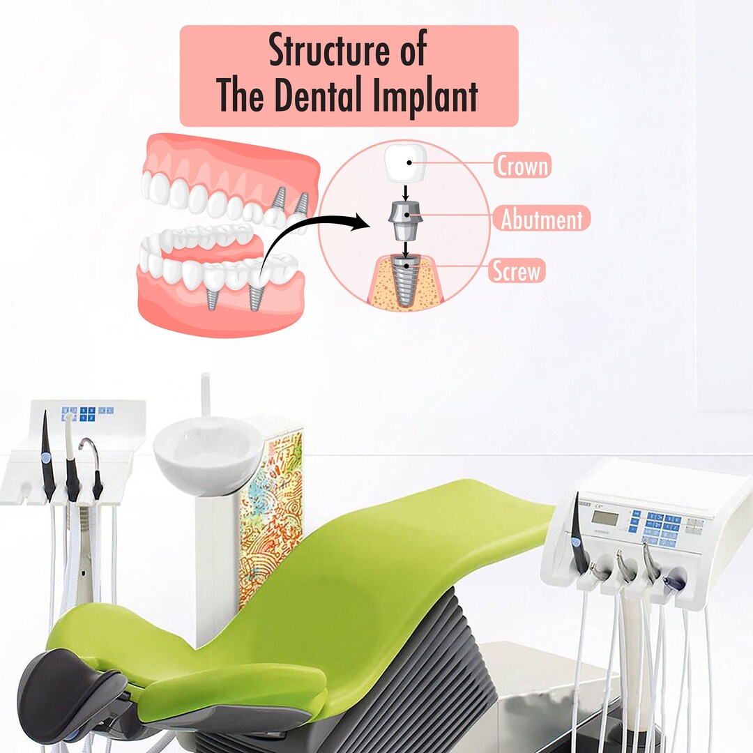 Curated visual reference: Gallery Detail: Dental Implant Wall Decor Smile Dental Stickers Dental Clinic Wall