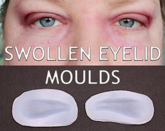 Pair of Swollen Eyelid Silicone Bondo Moulds for professional makeup artists to fill yourself  // Swelling Injury Casualty // SFX MAKEUP